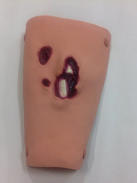 Bild in der Galerieansicht laden, Offene Fraktur, Schienbein