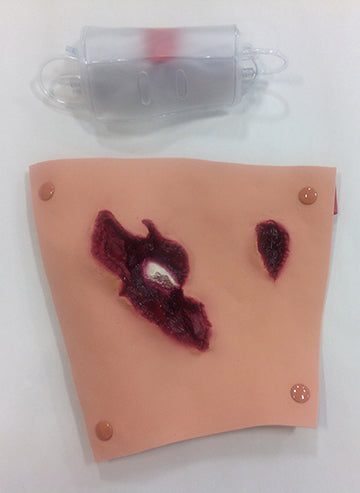 Carregar imagem no visualizador da Galeria, Fratura Composta do Fêmur