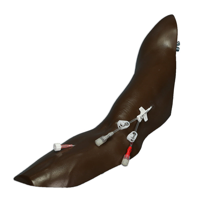 Load image into Gallery viewer, Chester Chest™ Standard Arm