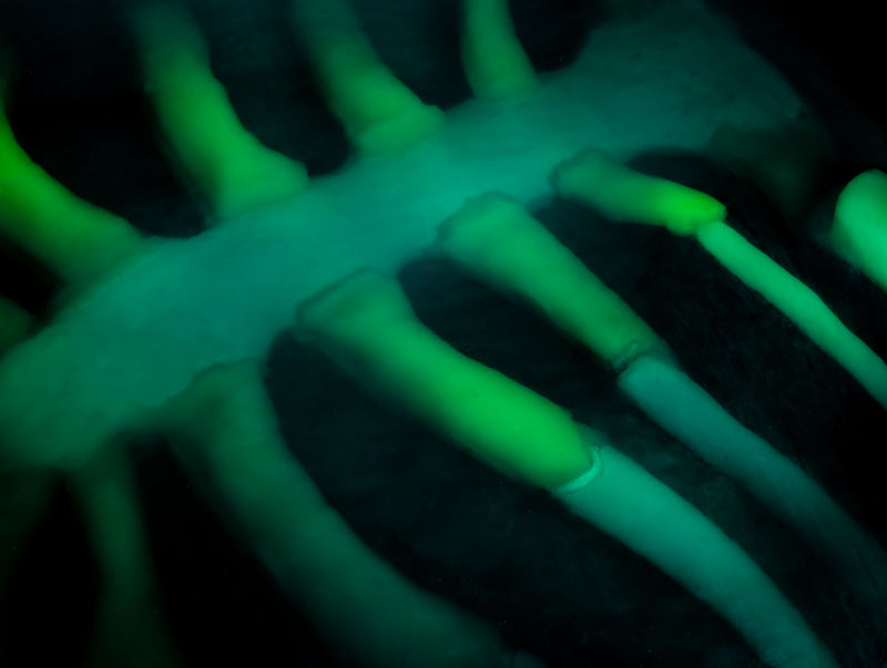 Cargue la imagen en el visor de la galería, Echo Eddie - Advanced Ultrasound Examination Trainer
