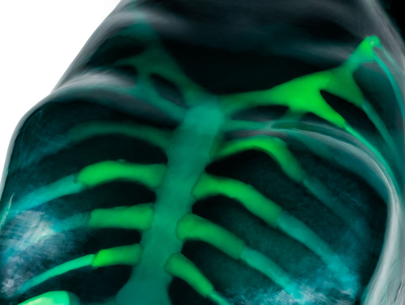 Cargue la imagen en el visor de la galería, Echo Eddie - Advanced Ultrasound Examination Trainer
