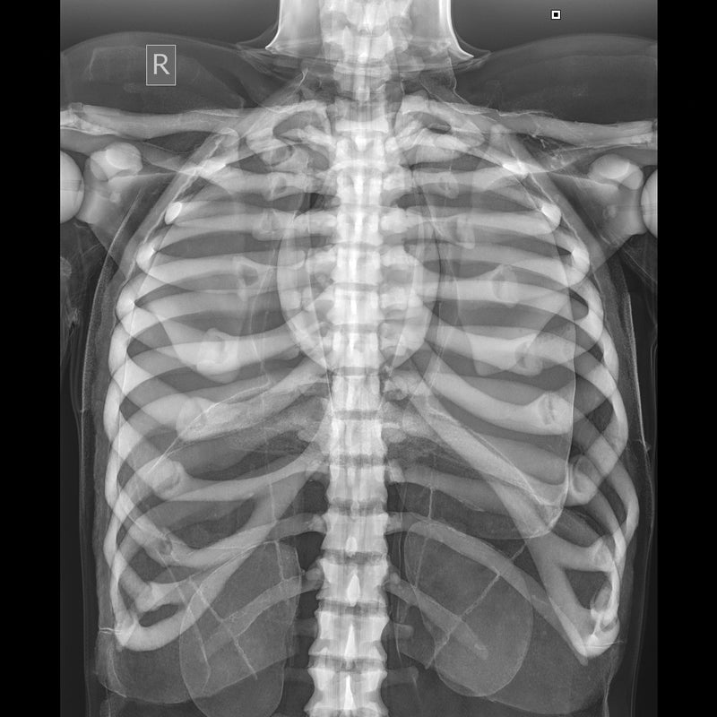 Load image into Gallery viewer, X-Ray Radiographic Positioning Manikin
