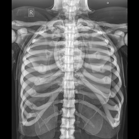 X-Ray Radiographic Positioning Manikin