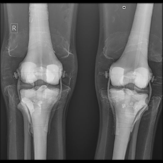 X-Ray Radiographic Positioning Manikin