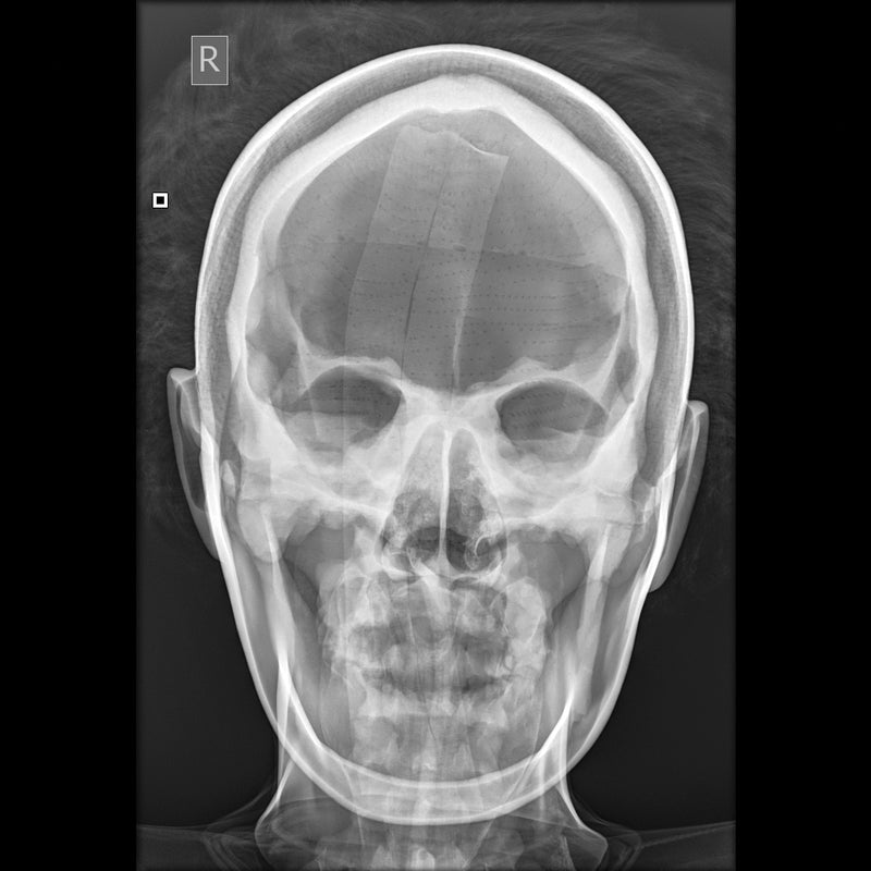 Load image into Gallery viewer, X-Ray Radiographic Positioning Manikin
