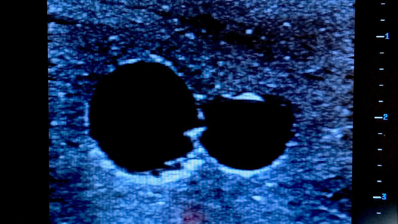 Tải hình ảnh vào trình xem Thư viện, Ultrasound Simulator with 2 Peripheral Veins
