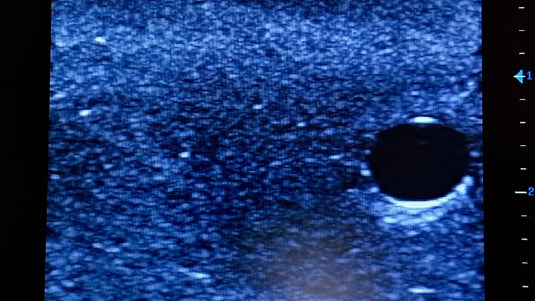 Ultrasound Simulator with 2 Branched Veins