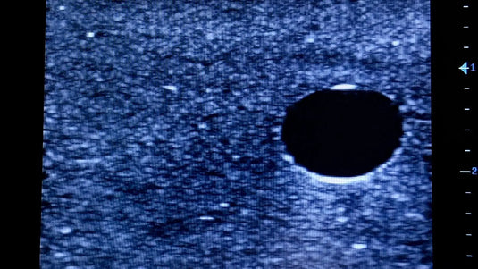 Ultrasound Simulator with 2 Central Lines