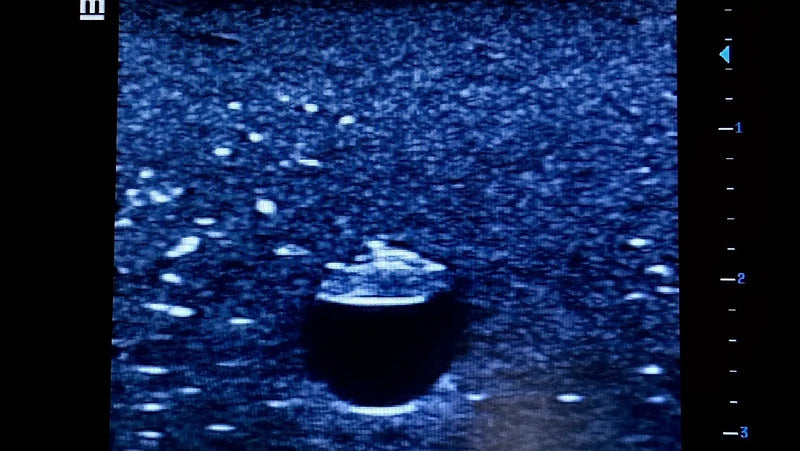 Cargue la imagen en el visor de la galería, Central Access Ultrasound Simulator with Calcifications
