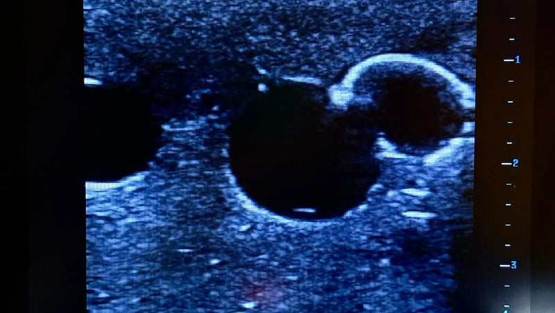 Tải hình ảnh vào trình xem Thư viện, Femoral Access Ultrasound Simulator with Aneurysms
