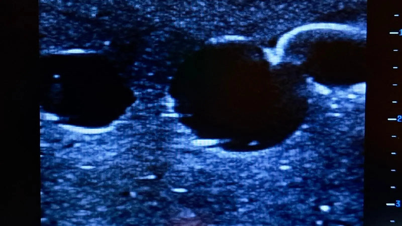 Tải hình ảnh vào trình xem Thư viện, Femoral Access Ultrasound Simulator with Aneurysms
