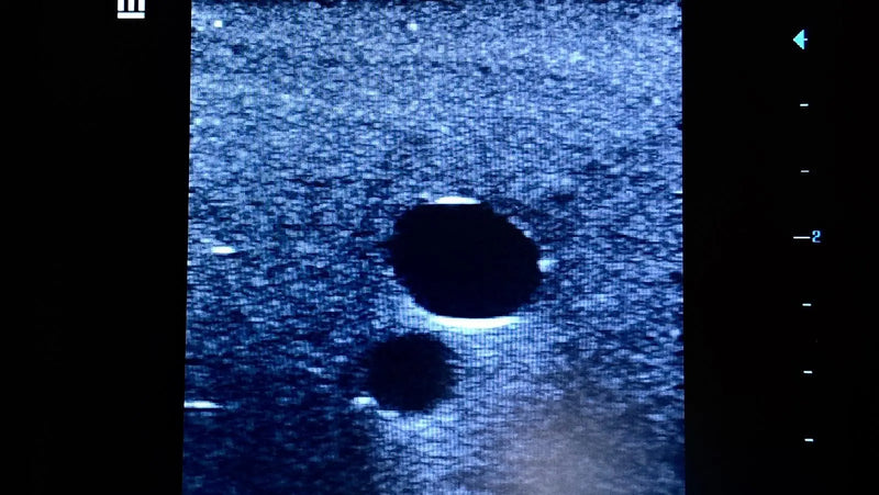 Tải hình ảnh vào trình xem Thư viện, Femoral Access Ultrasound Simulator with Aneurysms
