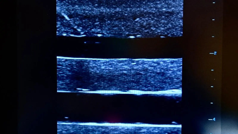 Tải hình ảnh vào trình xem Thư viện, Ultrasound Simulator with 4 Central Lines
