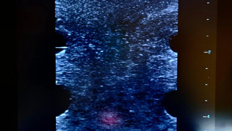 Tải hình ảnh vào trình xem Thư viện, Ultrasound Simulator with 4 Central Lines
