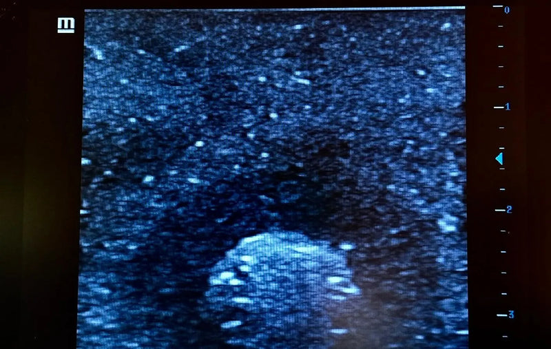 Tải hình ảnh vào trình xem Thư viện, Ultrasound Simulator with Breast Pathologies/Biopsy
