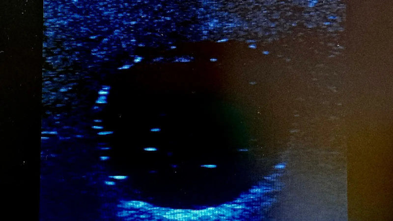 Tải hình ảnh vào trình xem Thư viện, Ultrasound Simulator with Breast Pathologies/Biopsy
