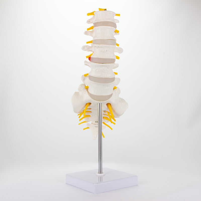 Load image into Gallery viewer, Lumbar Spine Model [SKU: MG21887]
