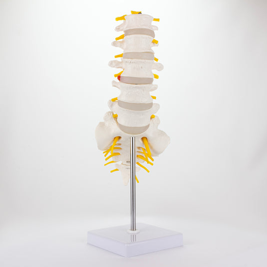 Lumbar Spine Model [SKU: MG21887]
