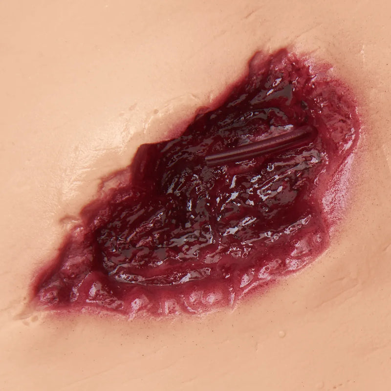 Carregar imagem no visualizador da Galeria, Fratura Composta do Fêmur
