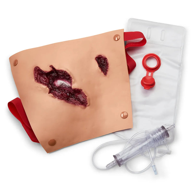 Carregar imagem no visualizador da Galeria, Fratura Composta do Fêmur
