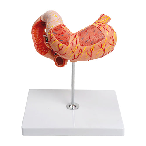 Model Lambung dengan Pankreas & Duodenum, 3 Bagian [SKU: MG40891]