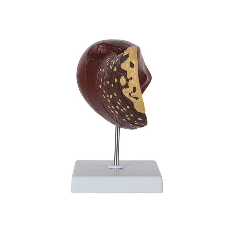 Chargez l&#39;image dans la visionneuse de la galerie, Section de foie avec modèle de pathologie  [SKU : MG36148]
