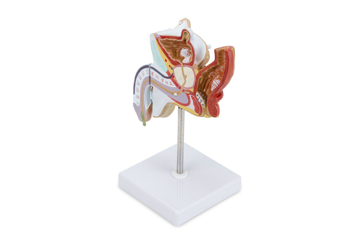 Male Genital Organ with Pathology Model, 2 parts [SKU: MG29949] – Nasco ...