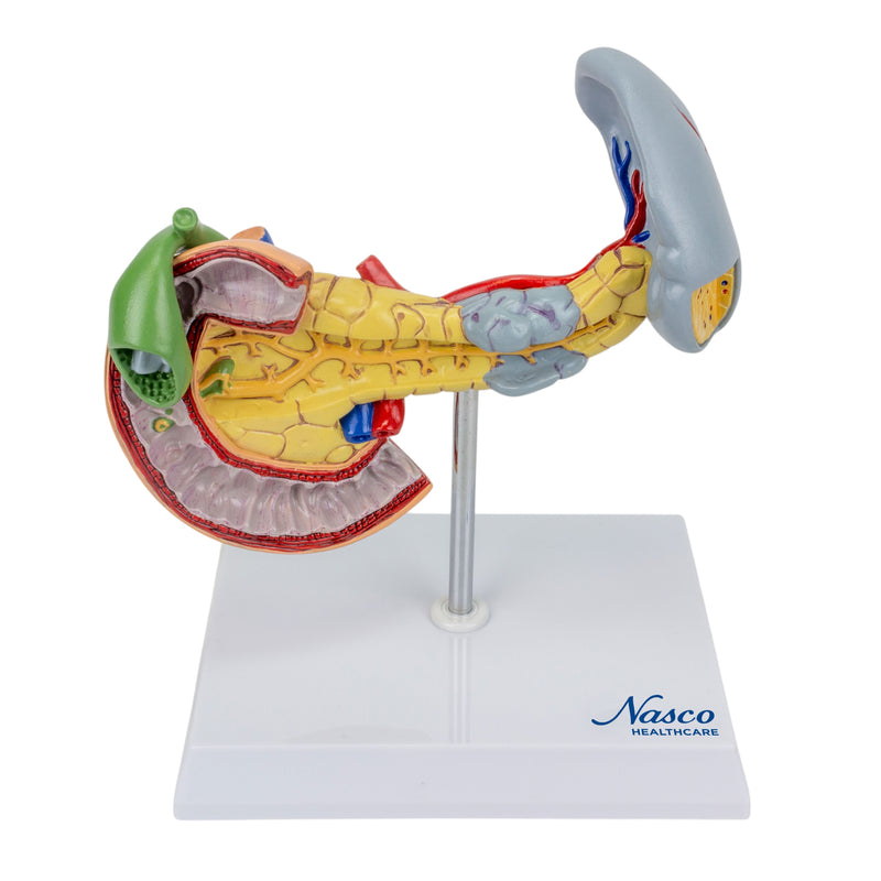 Load image into Gallery viewer, Pancreas, Spleen, and Gallbladder with Pathologies Model

