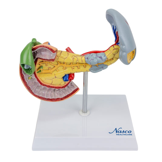Pancreas, Spleen, and Gallbladder with Pathologies Model