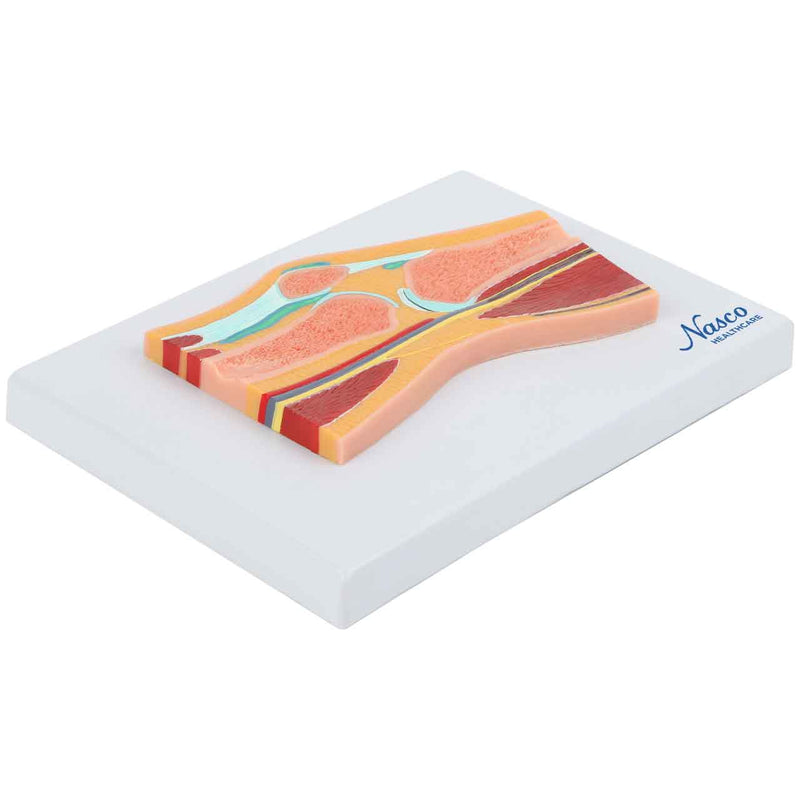 Carica immagine in Galleria Viewer, Modello del Ginocchio, Sezione Mediana [SKU: MG17222]

