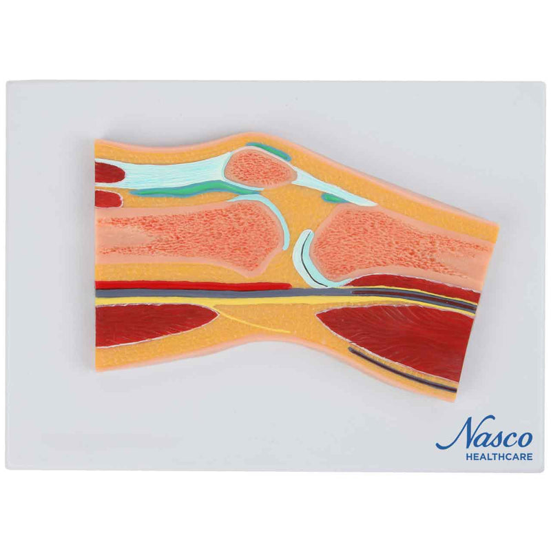 Carica immagine in Galleria Viewer, Modello del Ginocchio, Sezione Mediana [SKU: MG17222]
