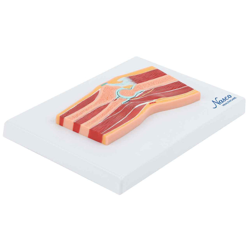 تحميل الصورة في عارض المعرض، نموذج الكوع، القسم الوسيط [SKU: MG17225]
