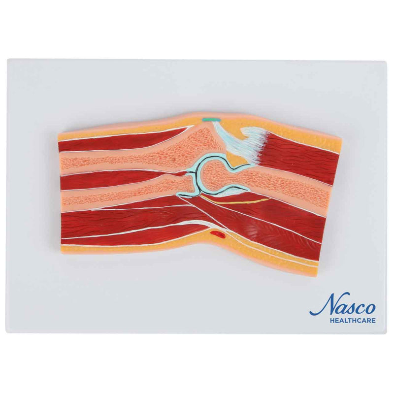 تحميل الصورة في عارض المعرض، نموذج الكوع، القسم الوسيط [SKU: MG17225]
