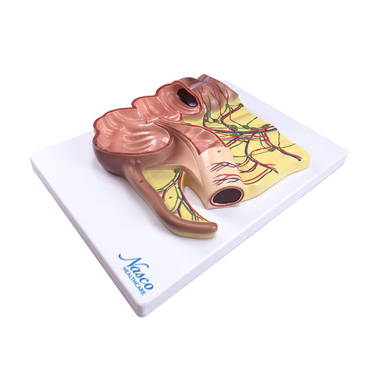 Appendix Modek, 2X Enlarged