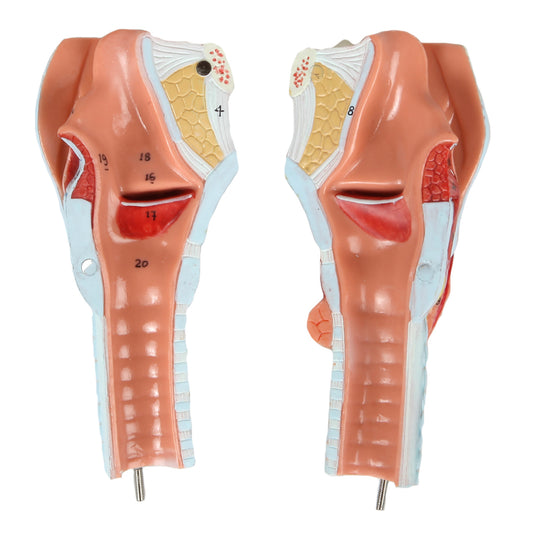 Bronchialbaum mit Kehlkopfmodell [SKU: MG20231]