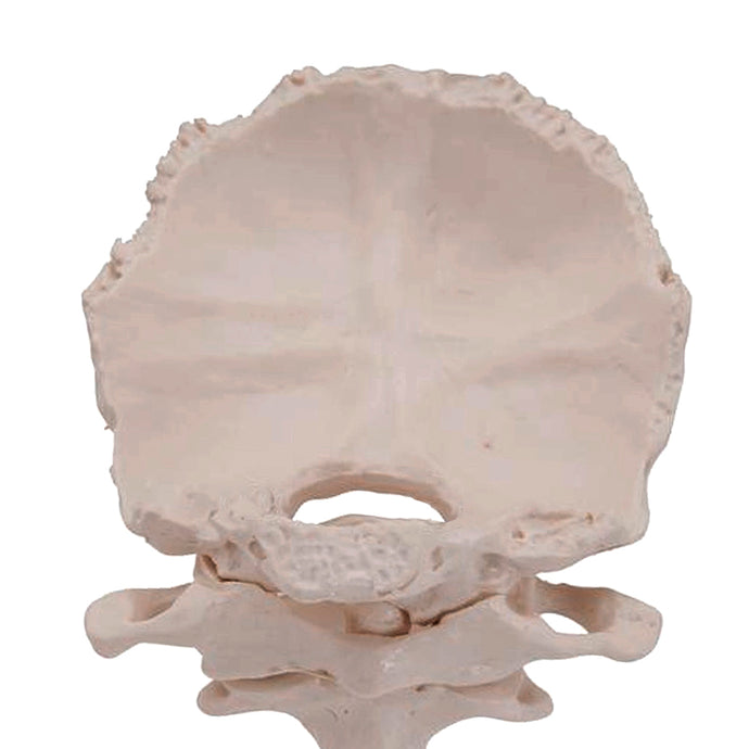 Atlas and Axis with Occipital Plate Model