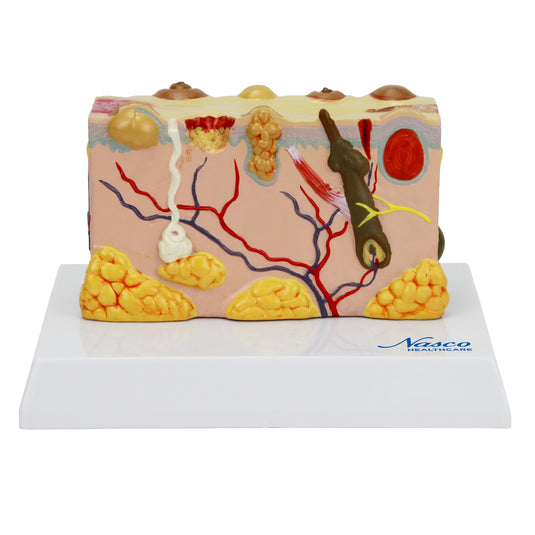 Skin Section with Pathology Model, 30X Enlarged