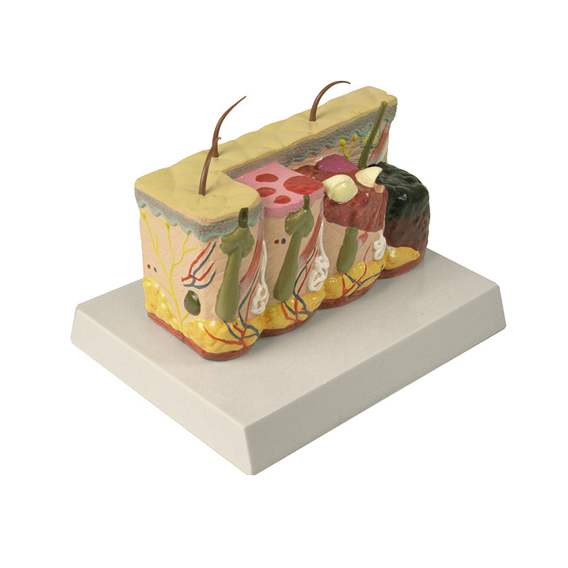 Load image into Gallery viewer, Skin Section with Burn Model, 30X Enlarged
