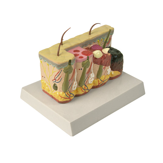 ส่วนผิวหนังพร้อมแบบจำลองการเผาไหม้ ขยาย 30 เท่า [SKU: MG21066]