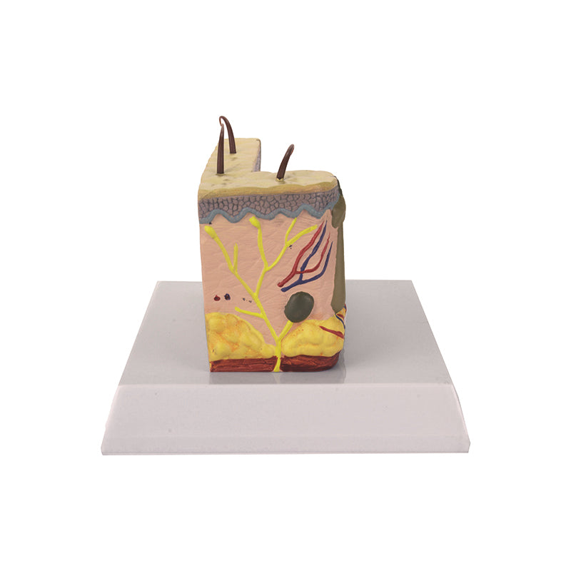 Load image into Gallery viewer, Skin Section with Burn Model, 30X Enlarged
