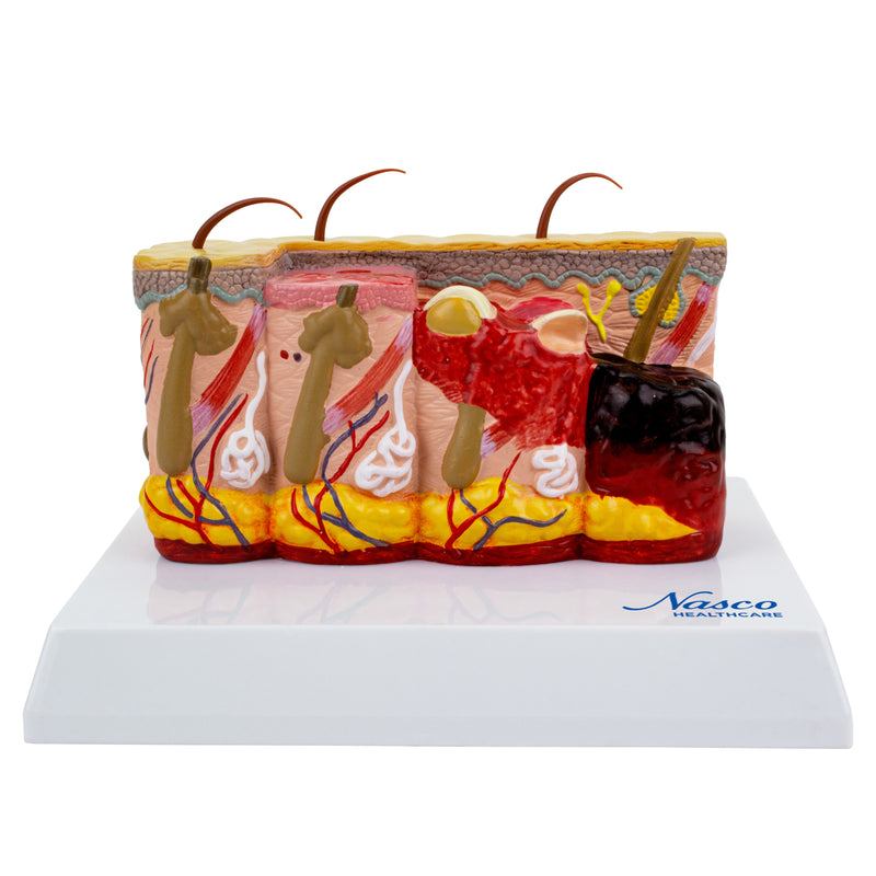 Load image into Gallery viewer, Skin Section with Burn Model, 30X Enlarged
