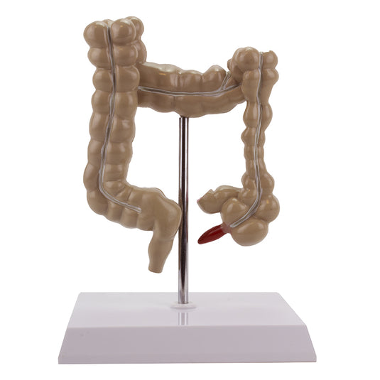 Dickdarm mit intestinalen Pathologien Modell [SKU: MG21850]