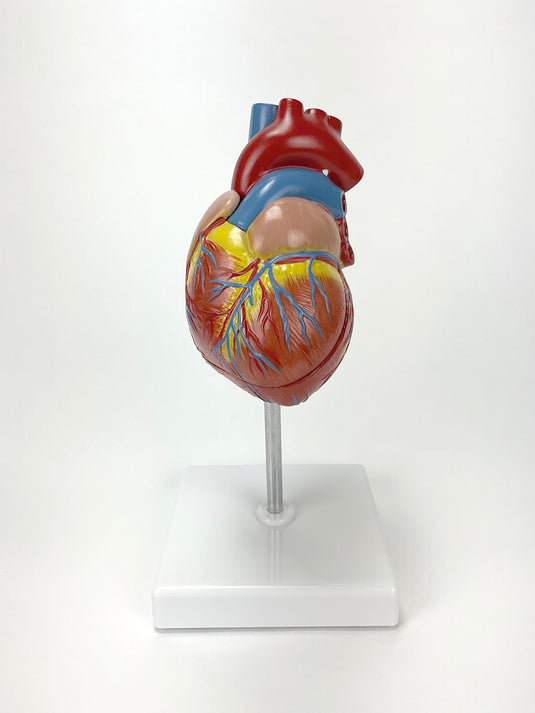 نموذج القلب الكلاسيكي مع تضخم البطين [SKU: MG22274]