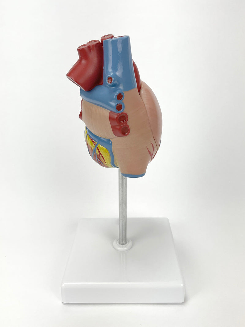 تحميل الصورة في عارض المعرض، نموذج القلب الكلاسيكي مع تضخم البطين [SKU: MG22274]
