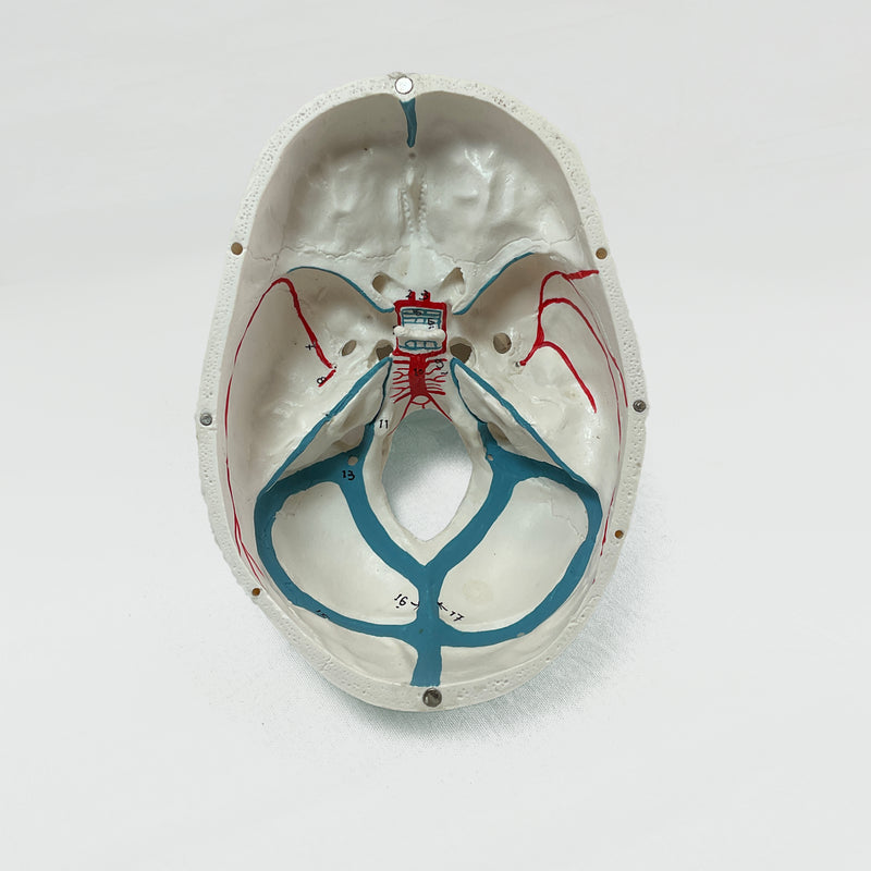 Load image into Gallery viewer, Skull with Blood Vessels Model
