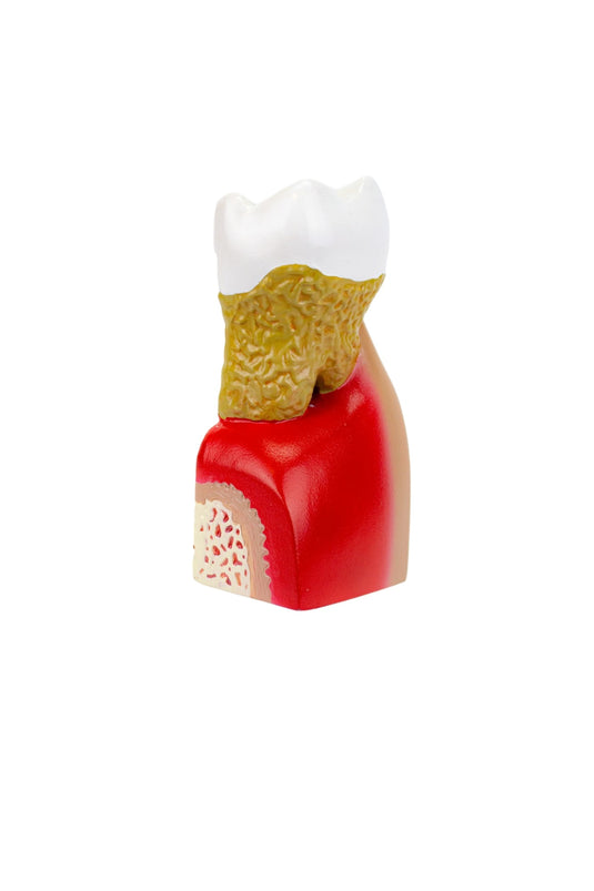 Modelo de Enfermedad Dental, 10X Ampliado [SKU: MG22727]