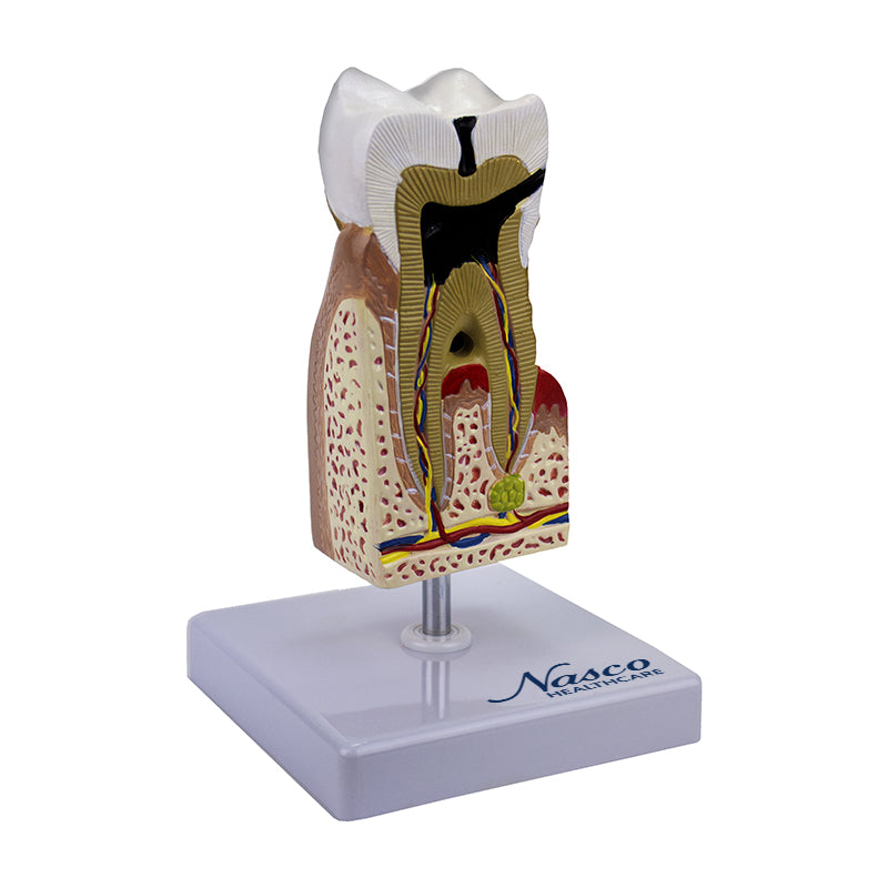 Cargue la imagen en el visor de la galería, Modelo de Enfermedad Dental, 10X Ampliado [SKU: MG22727]
