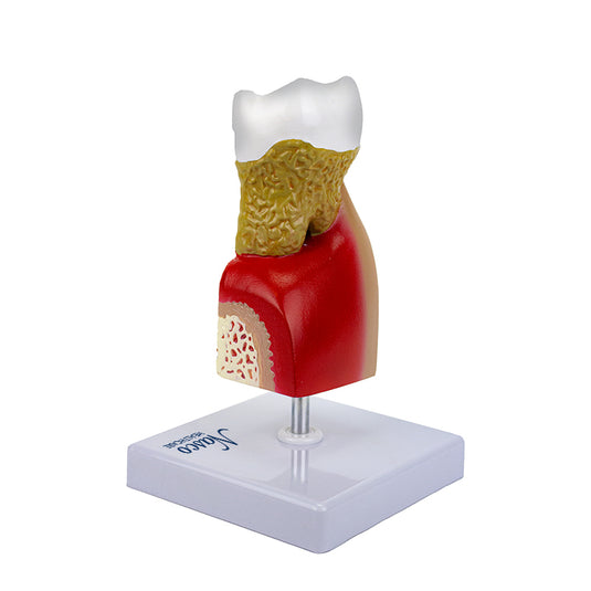 Modelo de Enfermedad Dental, 10X Ampliado [SKU: MG22727]