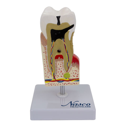 Modelo de Enfermedad Dental, 10X Ampliado [SKU: MG22727]