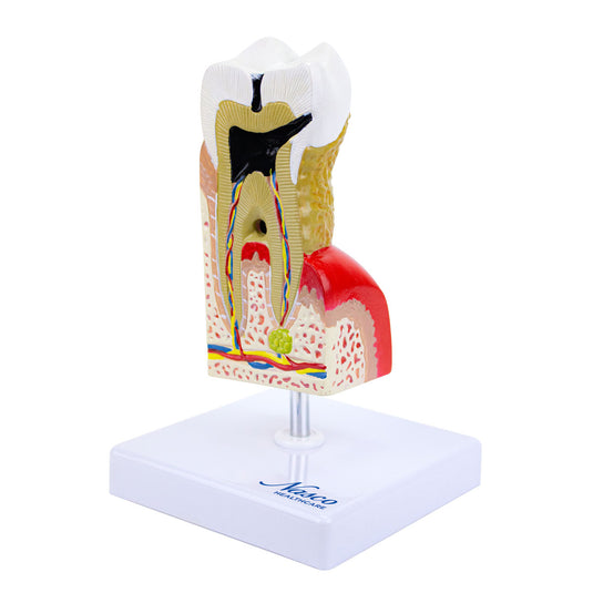 Modelo de Enfermedad Dental, 10X Ampliado [SKU: MG22727]